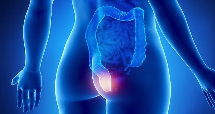  ಗುದದ ರೋಗಗಳು Anal Diseases – 3